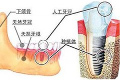 如何告别“老掉牙”？